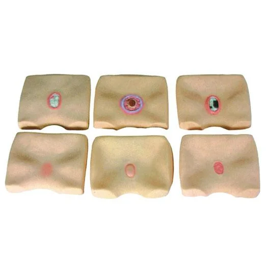 各期褥疮护理模型KAS/RC-6 高清实拍图