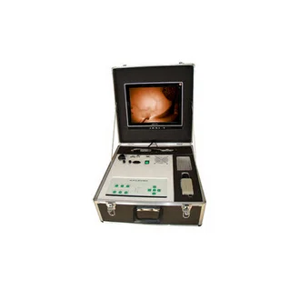普通一体式彩色红外乳腺诊断仪 ZJ-8000B 高清实拍图