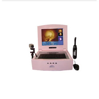 豪华电脑一体式红外乳腺诊断仪 ZJ-8000C