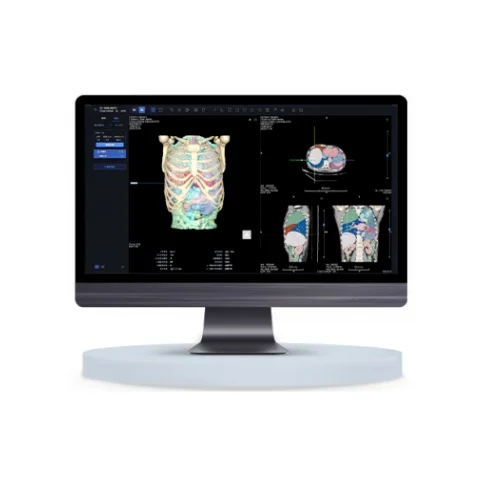 海杰亚HYVISION™肝脏CT图像处理软件3DVisualization 高清实拍图