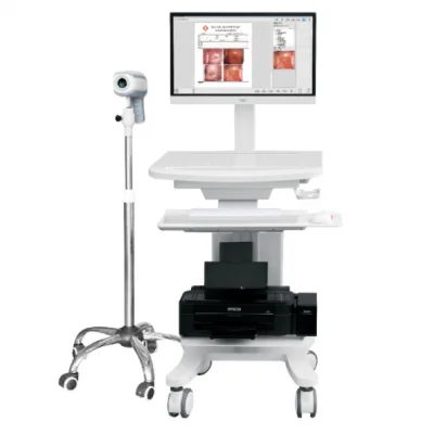 天飞电子阴道镜TF-6000高清型300