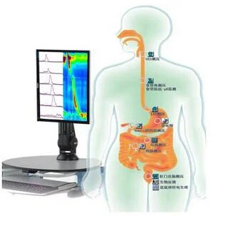 胃肠动力学检查系统 Solar GI