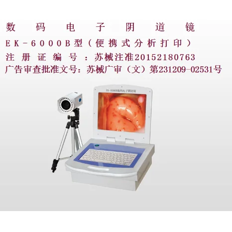 亿康盈联数码电子阴道镜（彩色液晶分析打印）EK-6000B 高清实拍图