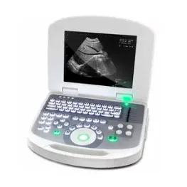 Sunway Medical便携式B超机 3W-2100 高清实拍图